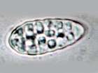Arthonia ruana A. Massal