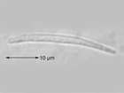 Bacidia bagliettoana (A. Massal. & De Not.) Jatta