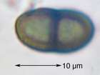 Buellia aethalea (Ach.) Th. Fr.