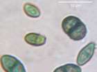 Calicium abietinum Pers.