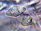 Caloplaca flavescens (Huds.) J. R. Laundon