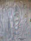 Caloplaca subpallida H. Magn.