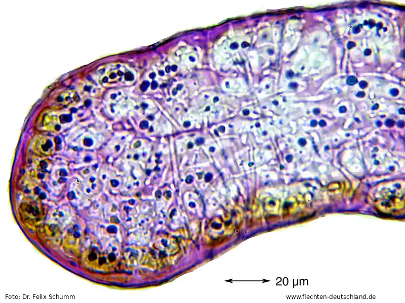 Mikromerkmale | Foto von Dr. Felix Schumm