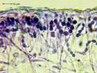 Collema subnigrescens Degel.