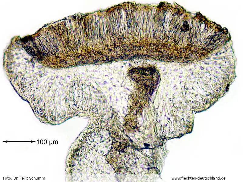 Fruchtkörper | Foto von Dr. Felix Schumm