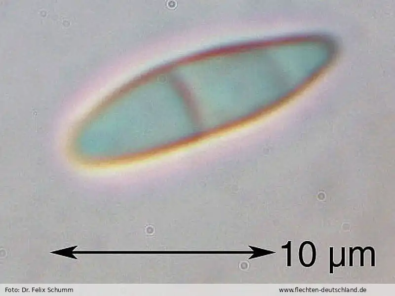 Querschnitt Fruchtkörper | Foto von Dr. Felix Schumm