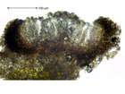Diploicia canescens (Dicks.) A. Massal.