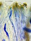 Diploschistes diacapsis (Ach.) Lumbsch