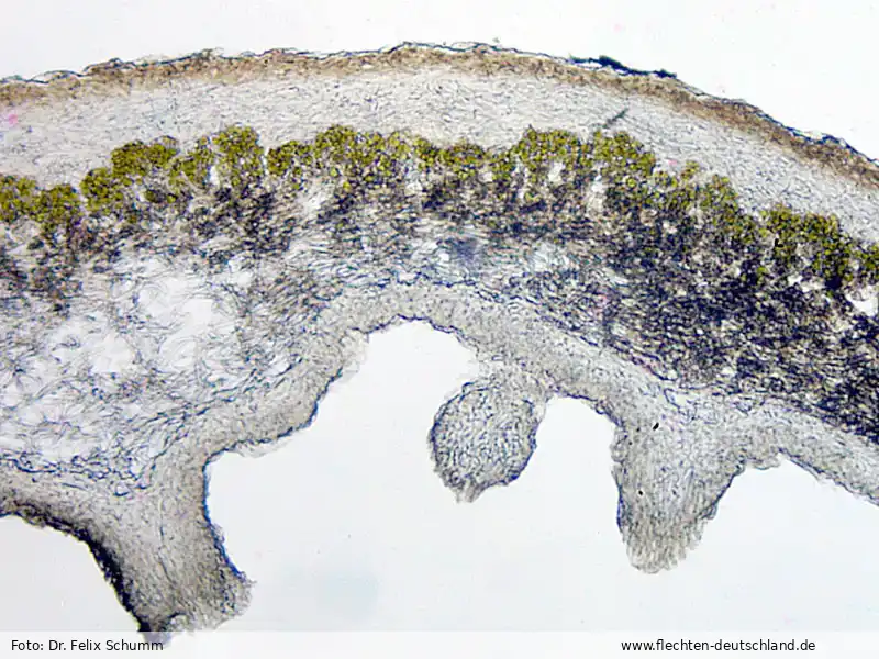 Mikromerkmale | Foto von Dr. Felix Schumm