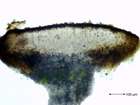 Miriquidica atrofulva (Sommerf.) A. J. Schwab & Rambold