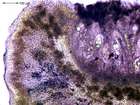 Ochrolechia parella (L.) A. Massal.